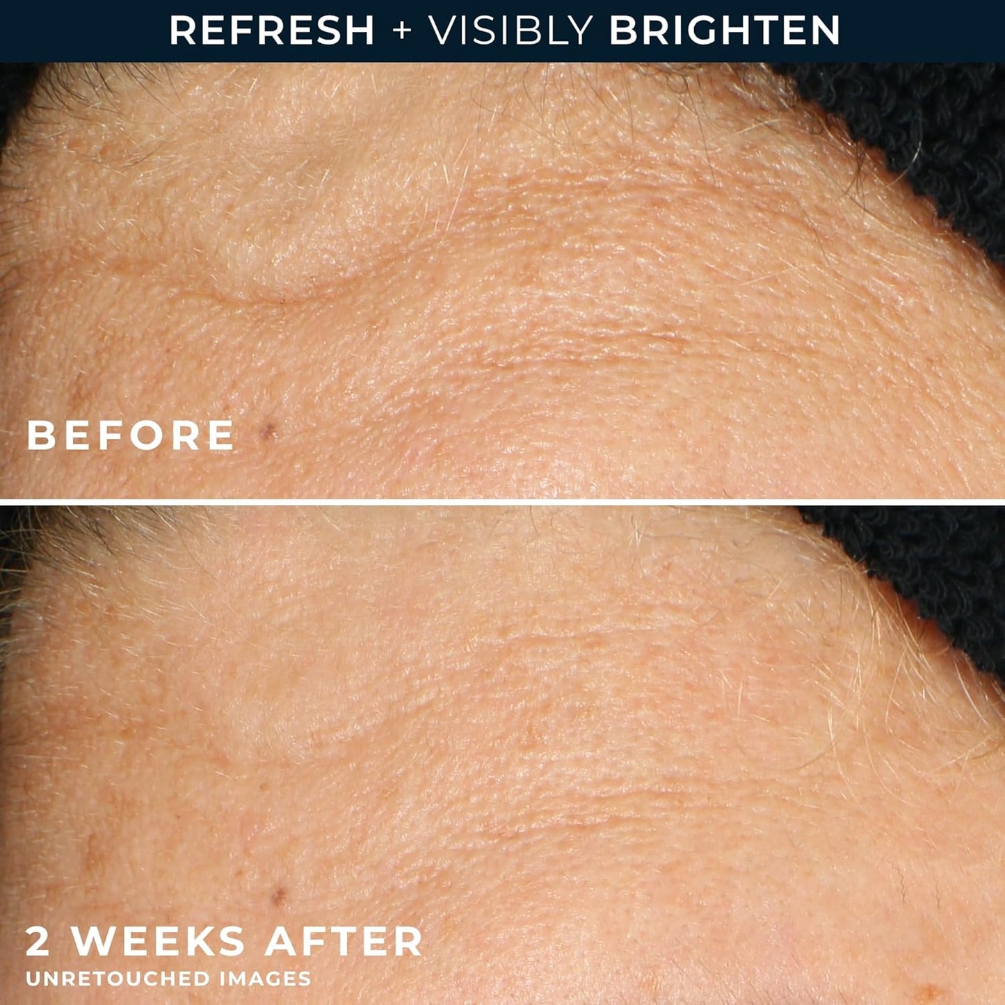 RoC Multi Correxion Revive + Glow Gel Vitamin C Cleanser, Face Wash, Facial Cleanser with Glycolic Acid, Paraben-Free, Sulfate-Free Skin Care - 6 Ounces