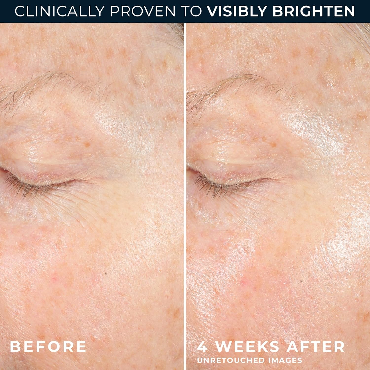 RoC Multi Correxion Revive + Glow 10% Vitamin C Moisturizer for Face, Anti-Aging Gel Cream, Instant Glow, Hypo-Allegenic, Oil-Free, 1.7 Ounces (Packaging May Vary